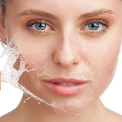 dermahealth-peeling-facial